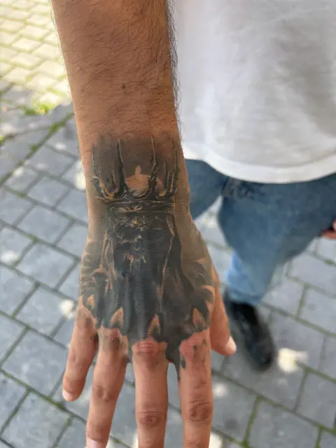 Healed hands right